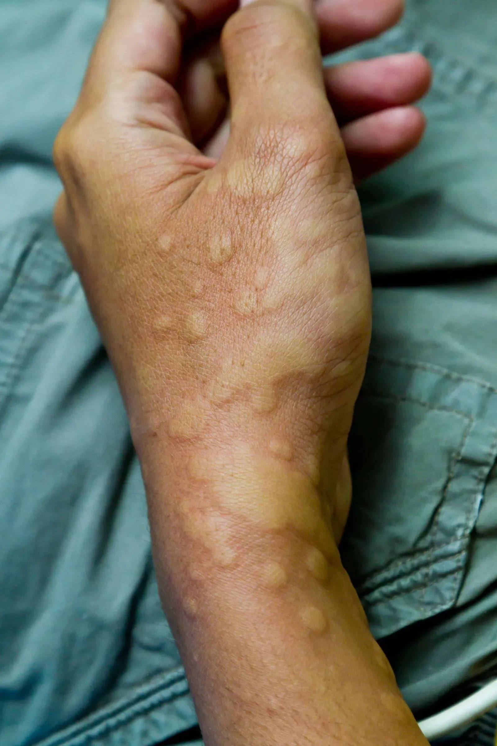 image 2ca9feb8 bf2f 435f 97a3 c70c18e9fb00.webp