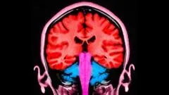 image 3ff40394 c26d 4156 9a51 b96ccbe2643b.webp