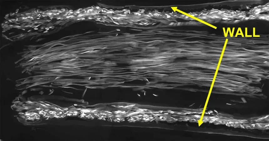 Spider Silk Nerve Repair: A Game Changer for Regeneration? image 898af729 0357 4324 8c24 16e77beba1f7.webp
