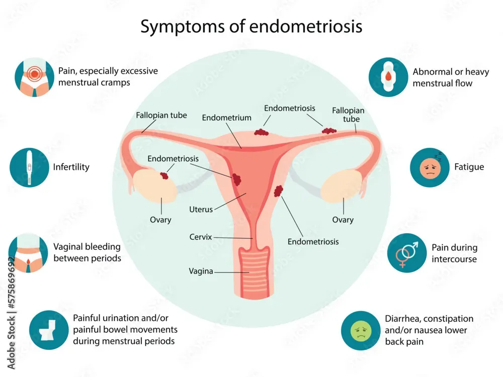 image 0e10cffe 3527 47c9 8928 a0995bc39cd1.webp